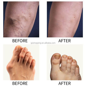 Krim Perawatan Kaki Perfectx 250g, Kolagen Laris Manis dengan Aroma Herbal Alami dan Efek Menenangkan Nyeri Sendi dan Tulang - Product Image 5