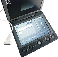Ecógrafo Doppler Color SonoScape S9 S9V de 128 Canales, Escáner de Ultrasonido Portátil para Clínica Veterinaria, Hospital y Granja