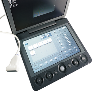 Ecógrafo Doppler Color Veterinario SonoScape S9V, Escáner Portátil de Alto Rendimiento para Uso Clínico, de Campo y Emergencias - Product Image 3