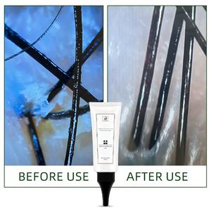 Salon Head Spa Kopfhaut Make-up Entferner Kopfhaut Peeling Detox Produkt Kopfhaut Reinigungs creme für ölige, empfindliche und Schuppen - Product Image 2