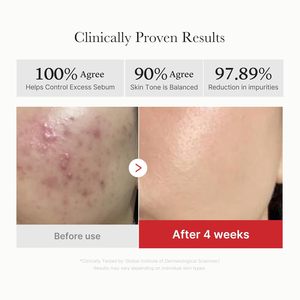 Medicube Red Succinic Acid Peeling Pad 0.5% Niacinamide 2% Pour Peaux à Tendance Acnéique Exfoliant - Product Image 4
