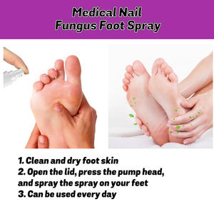 Gran oferta, textura cómoda y refrescante, piel fresca de absorción rápida para mantener la piel del pie, espray para el cuidado de los pies - Product Image 5