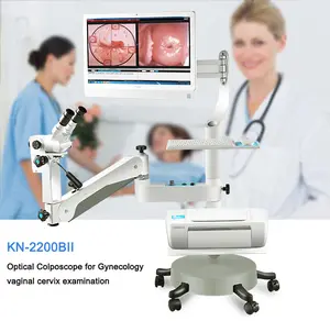 HD Camera Electronic Digital Video Colposcope for Vagina Gynecology Optic Colposcope Software Digital Colposcope