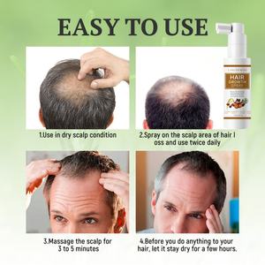 Spray pour la croissance des cheveux, avec huile de romarin et biotine, non gras, aide à prévenir l'amincissement et la chute des cheveux - Product Image 5