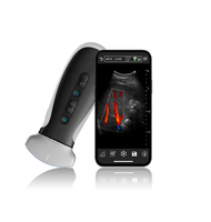 Dispositivo de imagen inteligente lineal cardíaco de matriz en fase Doppler de color de alta calidad 192 elementos WiFi ultrasonido inalámbrico