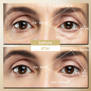 Un appareil de beauté pour les yeux qui combine microcourant et vibration, instrument de beauté pour les yeux qui soulage les cernes et les poches sous les yeux. - Product Image 4