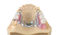 Inserts de moules et matrices, pièces métalliques, imprimante 3D Procisio3d, service d'impression 3D de bijoux, traçabilité complète, imprimante 3D, imprimante métallique