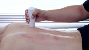 Professional Traditional <strong>Medical</strong> <strong>Cupping</strong> and Guasha Massager Set Electric Vaccum <strong>Cupping</strong> Therapy Machine - Product Image 6