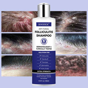 Shampoo anti-prurigineux le plus vendu, dermatite séborrhéique, <span class=keywords><strong>psoriasis</strong></span>, soulagement des démangeaisons, élimination des pellicules, folliculite - Product Image 5