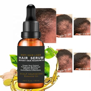 Croissance des cheveux Huile essentielle Rapide Efficace Bio gingembre soin des cheveux pour cuir chevelu nourrissant anti perte sérum réparateur pour hommes et femmes - Product Image 1
