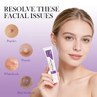 Crème à l'acide azélaïque 12% en marque propre, gel anti-acné, apaise les rougeurs, crème pour le visage à la niacinamide, crème éclaircissante à la vitamine C
