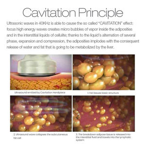<span class=keywords><strong>SVATAR</strong></span> Máquina de Cavitación de 40Khz con 5 Manijas, Vacío y Radiofrecuencia para Reducción de Grasa y Adelgazamiento Corporal - Product Image 3
