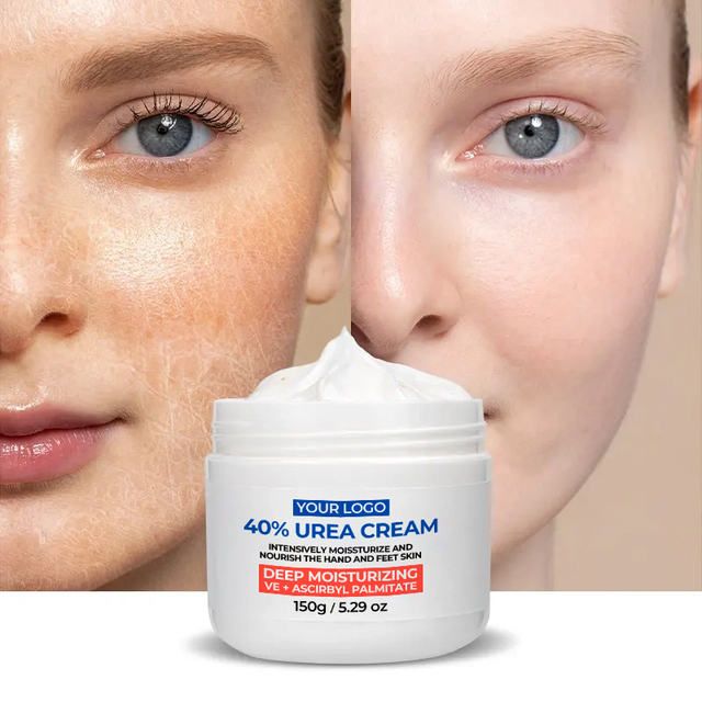 OEM ODM Urea Cream 40 Percent Face Cream Facial Cream Face Lotion for Deep Moisturizing Whitening Nourishing Lightening Firming