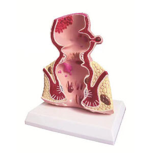 Modèle anatomique humain agrandi pour l'enseignement médical : système digestif, appendice et cæcum - Product Image 4