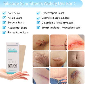 Crème cicatrisante au silicone <span class=keywords><strong>pour</strong></span> le traitement du visage, marque privée, avec formule réparatrice - Product Image 6