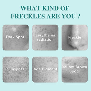 Crème personnalisée à l'arbutine et à l'acide kojique, la meilleure crème <span class=keywords><strong>pour</strong></span> la pigmentation, le mélasma, le blanchiment de la peau, la niacinamide, crème <span class=keywords><strong>pour</strong></span> le visage - Product Image 3