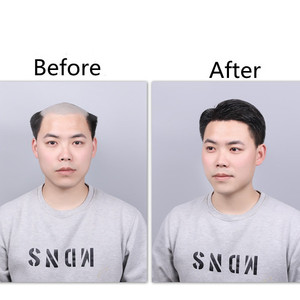 TP ธรรมชาติและที่มองไม่เห็น Balding ผมแพทช์สำหรับผู้ชายผมเปลี่ยนจริงบราซิลมนุษย์ผมปลอม - Product Image 3
