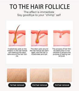 Appareil d'épilation au laser à diode à 4 longueurs d'onde portable avec grand écran pour le rajeunissement de la peau - Product Image 5