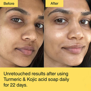 Saponetta naturale per la pelle alla curcuma per viso e corpo per macchie scure e aree intime efficace per la cura delle ascelle - Product Image 2