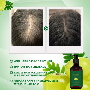 Nueva fábrica de spa para el cabello, mejora el control del aceite del cuero cabelludo, tratamiento de mascarilla para el cabello, esencia <span class=keywords><strong>Rogaine</strong></span>, antipérdida, juego de champú con aceite Amla - Product Image 2