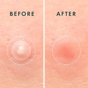 Hidratante de alta calidad Descubra los mejores productos Sadoer para brillar con el juego de cuidado de la piel <span class=keywords><strong>Koreano</strong></span> - Product Image 3