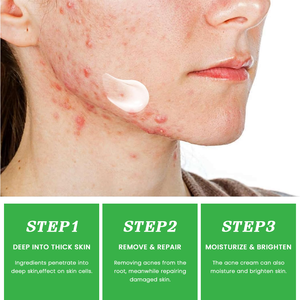 Atacado Whitening Creme Anti-Acne Creme Facial Com Ceramida Ácido Salicílico Hidrolisado Planta Colágeno Creme para o Rosto - Product Image 5