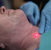 Fibre laser médicale en polyimide, revêtement 400um 600um, résistance aux hautes températures, fibre endolaser SMA905