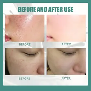 Private Label Silk Protein Skin Repair Soap Bar Natural Organic Handmade Goat <b>Milk</b> Facial Whitening Soap - Product Image 2