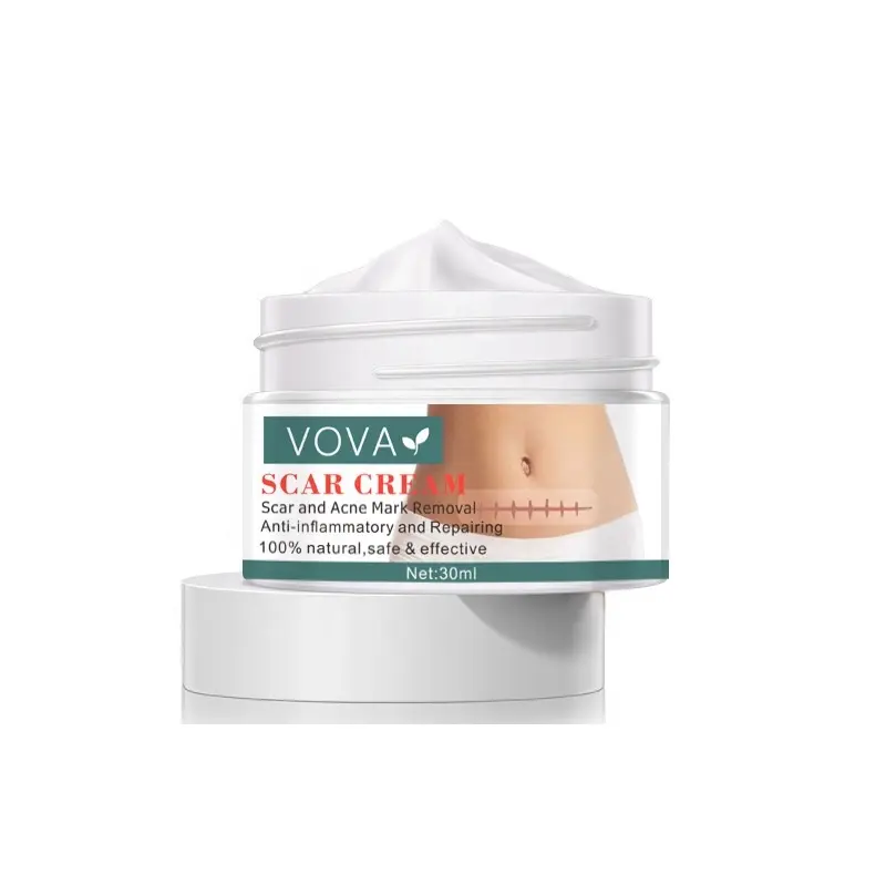 Hete Verkoop Snelle Anti Vlekken Striae Reparatie Behandeling Verlichting Acne Litteken Verwijdering Crème