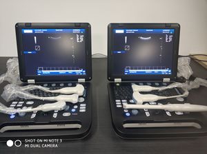 Ecógrafo <span class=keywords><strong>Doppler</strong></span> color digital básico de alta definición y alta resolución para exámenes obstétricos - Product Image 5