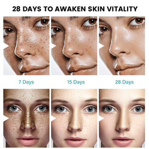 Crema Facial Blanqueadora para el Cuidado de la Piel, Elimina Pecas, Granos y Manchas Oscuras - Product Image 5