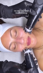 U900 Mềm Silicone Mặt Scrubber Làm Sạch Bàn Chải Khuôn Mặt Sạch Thiết Bị Mặt Exfoliator Mặt Massager Vẻ Đẹp Wand Facify - Product Image 6