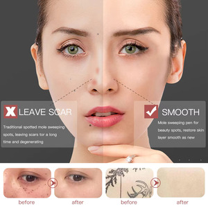 Stylo de suppression des excroissances cutanées, appareil de détection des grains de beauté, équipement de beauté du visage - Product Image 3