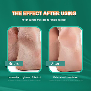 Herramienta de pedicura profesional, tratamiento removedor de maíz y <span class=keywords><strong>callos</strong></span>, piedra pómez, <span class=keywords><strong>Lima</strong></span> Exfoliante para pies para la eliminación de piel muerta - Product Image 4