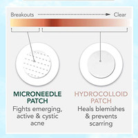 Patchs anti-acné à l'acide salicylique à marque privée, patchs auto-dissolvants à micro-aiguilles pour l'acné, patchs anti-boutons pour le soin de la peau
