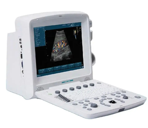 Appareil d'échographie Doppler couleur portable Edan U50, instruments d'échographie médicale pour le diagnostic clinique humain - Product Image 1