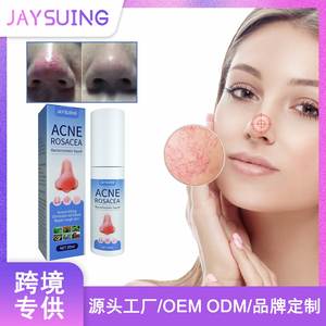 Jaysuing nhãn hiệu riêng mụn trứng cá rosacea điều trị Mũi Đỏ Thuốc mỡ huyết thanh acarus giết chết loại bỏ máu đỏ mũi sửa chữa da thô - Product Image 2