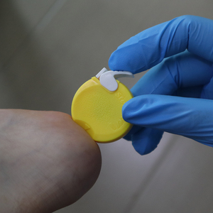 เข็มเจาะเลือดแบบใช้แล้วทิ้งสำหรับเด็กทารกเพื่อความปลอดภัยในการเจาะส้นเท้า - Product Image 3