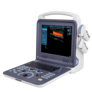 Mesin Ultrasound Doppler Warna Portabel 12 Inci Instrumen Ultrasound Medis Doppler Ultrasound Warna Penuh Digital