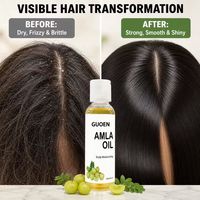Huile capillaire Amla hydratante pour le cuir chevelu 118ml, huile de soin capillaire à l'indienne groseille pour cheveux secs et crépus, lissante