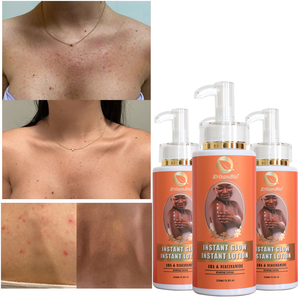 Carotene tự nhiên loại bỏ các đốm đen làm sáng <span class=keywords><strong>d</strong></span>ưỡng ẩm Kem <span class=keywords><strong>d</strong></span>ưỡng da OEM 250ml làm trắng Kem <span class=keywords><strong>d</strong></span>ưỡng da - Product Image 2