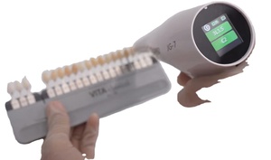 Colorímetro Dental Eléctrico Portátil, Dispositivo de Acero para Comparación de Tonos Dentales, para Consultas Dentales In Situ - Product Image 3