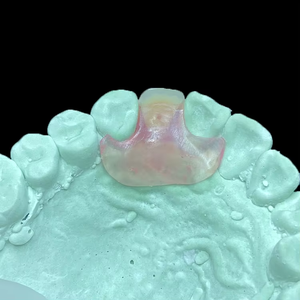 Prothèse <span class=keywords><strong>dentaire</strong></span> partielle amovible en résine flexible, invisible et incassable |   pour les laboratoires ou les cliniques | Fabriqué en Chine - Product Image 2