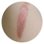 Pomada de Hialuronato de Sodio Bioactivo de Marca Privada OEM para la Eliminación de Cicatrices, Curación de <span class=keywords><strong>Heridas</strong></span> y Reparación de Estrías, 20g - Product Image 5