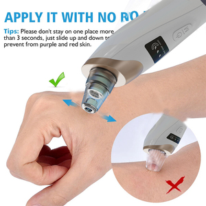 Appareil de nettoyage facial électrique OEM HY9 pour l'élimination des points noirs et de l'acné, aspirateur de pores, instrument de beauté - Product Image 5