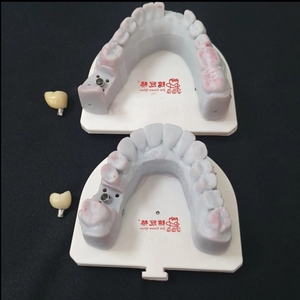 ส่วนบนของฟันเทียมไทเทเนียมพิมพ์ดิจิตอล3D แบบกำหนดเองเหมาะสำหรับระบบฝังหลัก - Product Image 1