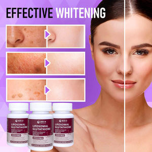 Gmp Private Merk Aangepaste Label Hoge Kwaliteit Liposoom Glutathion Huid Whitening Pillen Antioxidant Whitening Capsules - Product Image 3