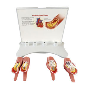 Vaso sanguigno malato modello SMM319 - Product Image 5