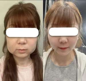 เซรั่มบำรุงผิวสูตรไลโปไลติกเพื่อการฟื้นฟูผิวอย่างมีประสิทธิภาพ - Product Image 2