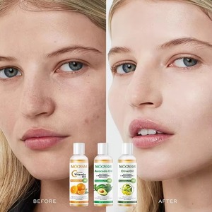 MOOYAM OEM 7 arancio Avocado <span class=keywords><strong>cocco</strong></span> ricino Jojoba Argan massaggio <span class=keywords><strong>olio</strong></span> essenziale <span class=keywords><strong>di</strong></span> massaggio <span class=keywords><strong>per</strong></span> i peli del corpo e del <span class=keywords><strong>viso</strong></span> - Product Image 1